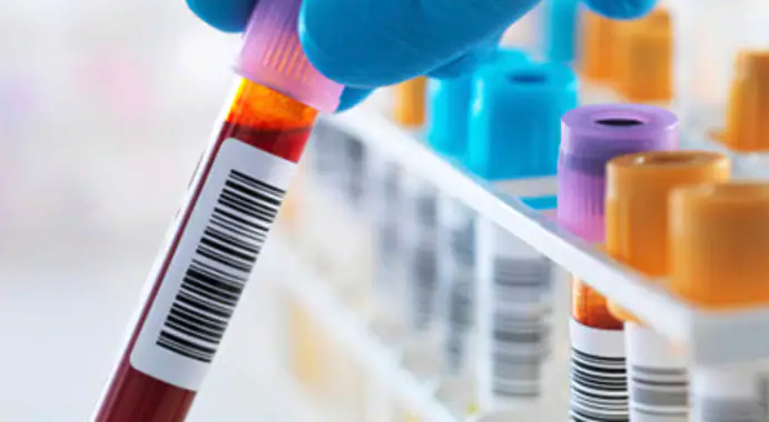 bloodtest bloodtest